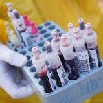 Doctors report uptick in surprising coronavirus complication: dangerous blood clots